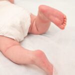 Diaper Dermatitis